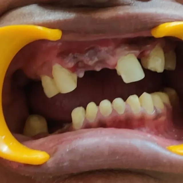 Before view of a patient smile transformation