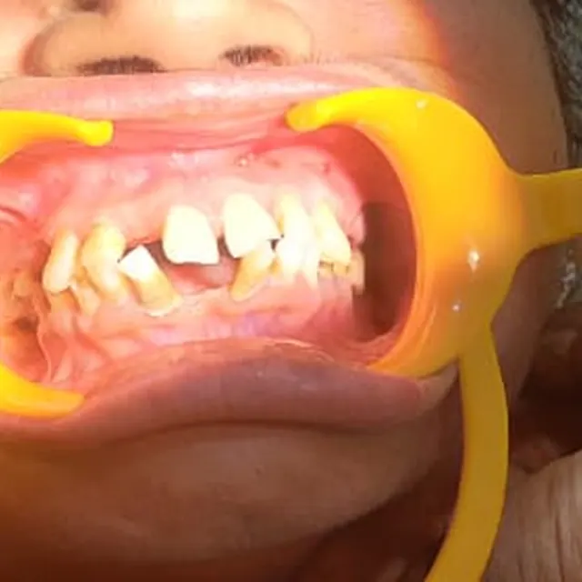 Before view of a patient smile transformation