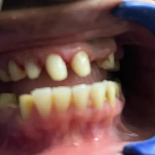 Before view of a patient smile transformation